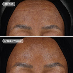 Ageless+ Retinol Treatment Crème 1.2%