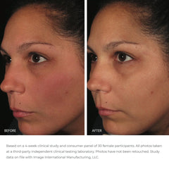 Balancing Antioxidant Serum